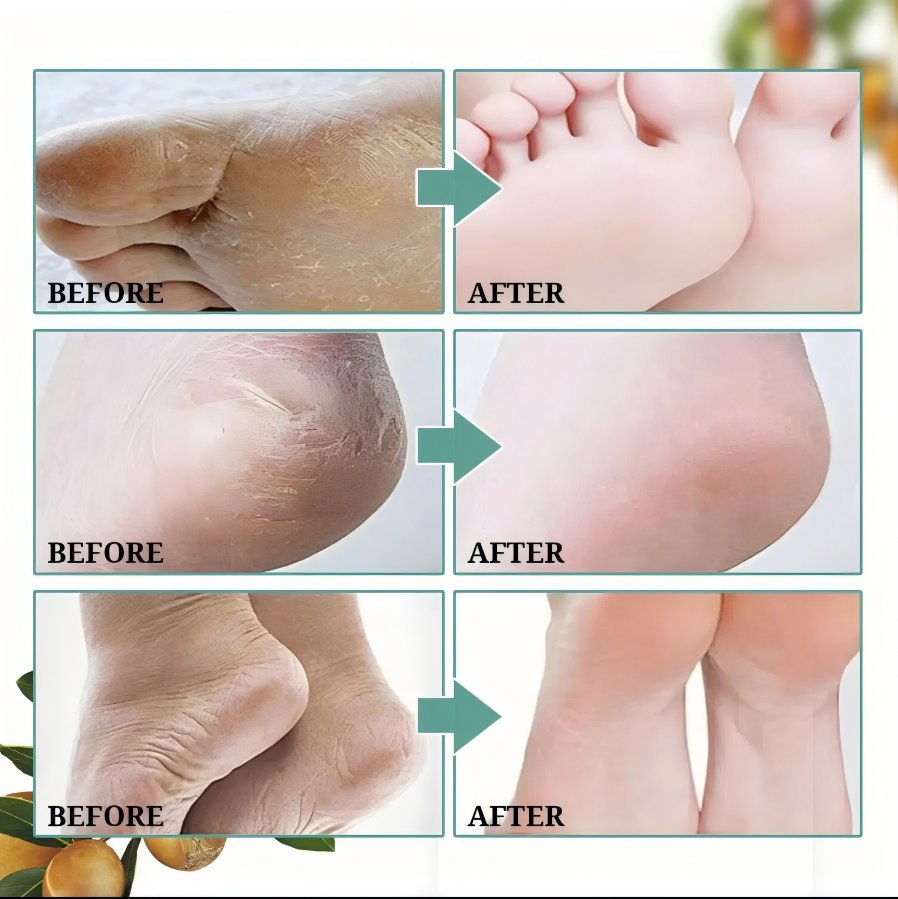 Horse Oil Exfoliates Foot Mask