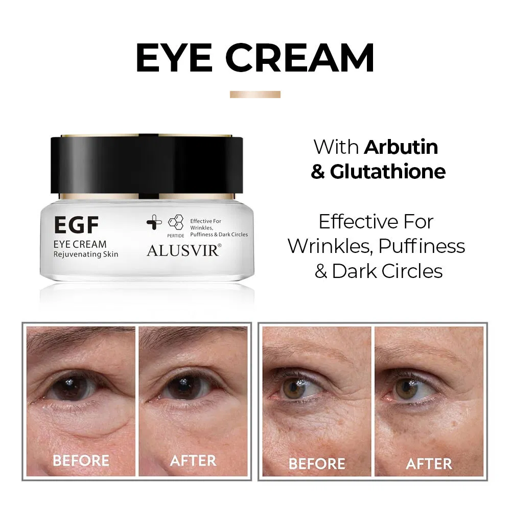EGF Eye Cream Peptide Collagen Niacinamide Anti Wrinkle Remove Eye Bags Rejuvenation