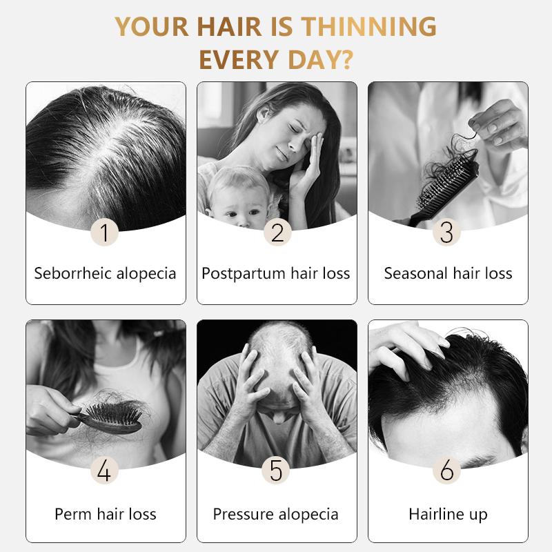 High Quality Biotin Hair Growth Serum for Anti-Loss Hair and Helping Hair Growth for Men and Women