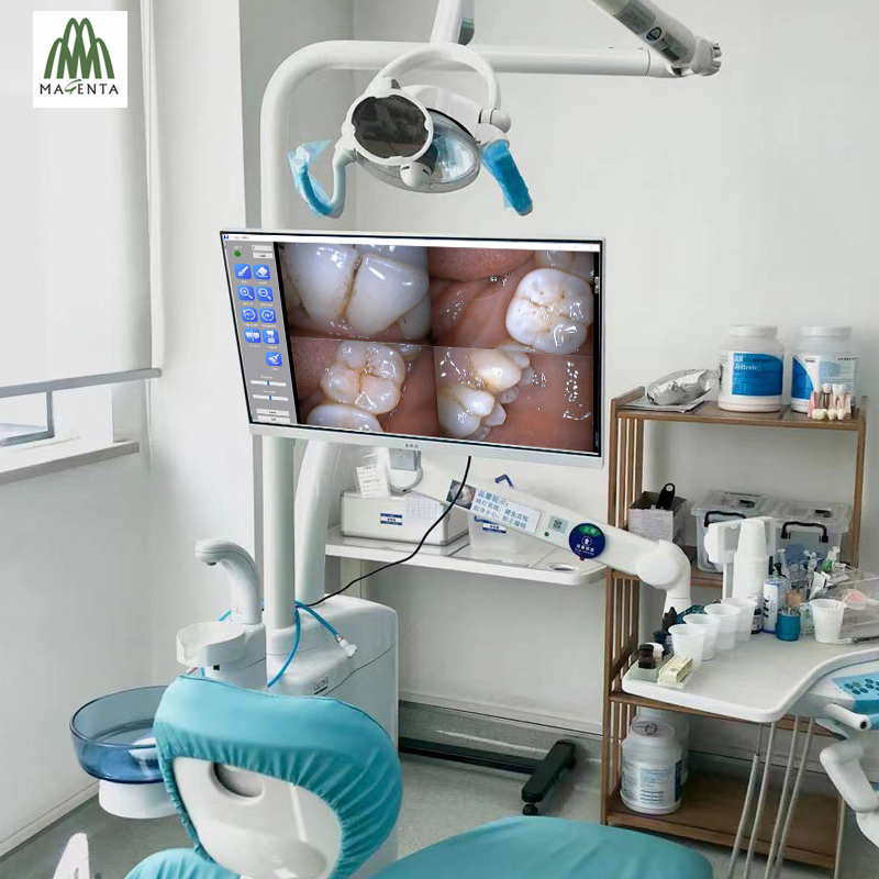 Sony CCD USB Wireless Dental Oral Camera Viewer for Dental Chair Computer