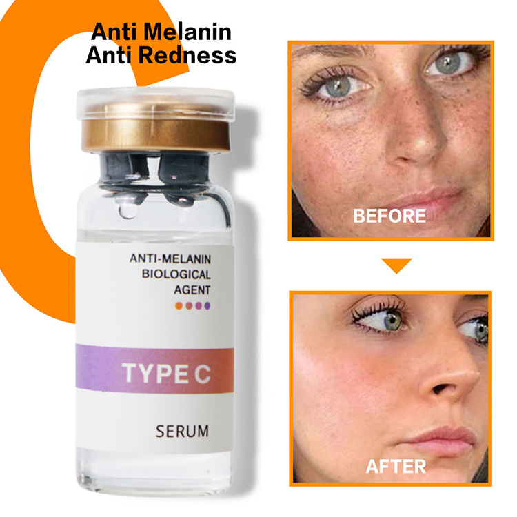 Body Skin Face Skin Ampoule Serum 10ml Cosmetics Whitening Melasma Serum 10ml