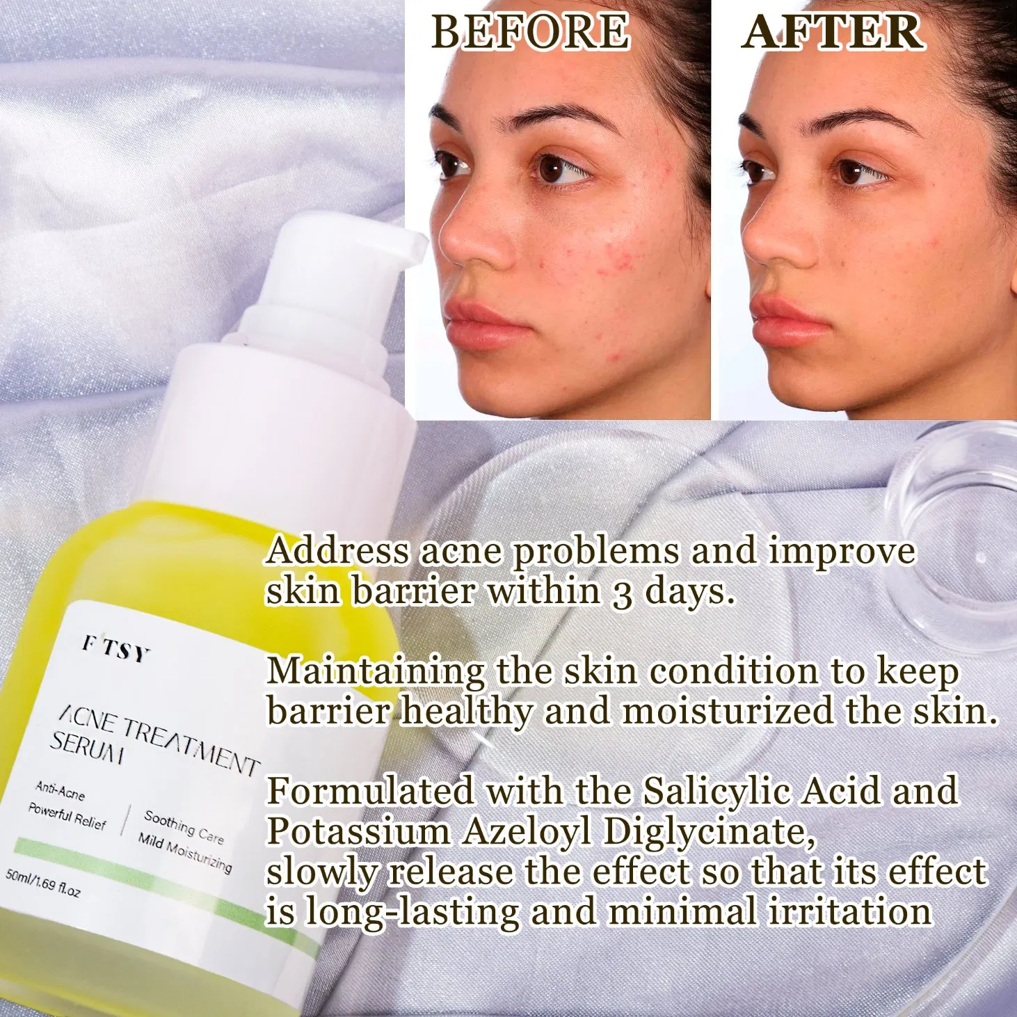 OEM Active Salicylic Acid Serum Pore-Cleaning Anti-Blemish Anti Acne Face Serum