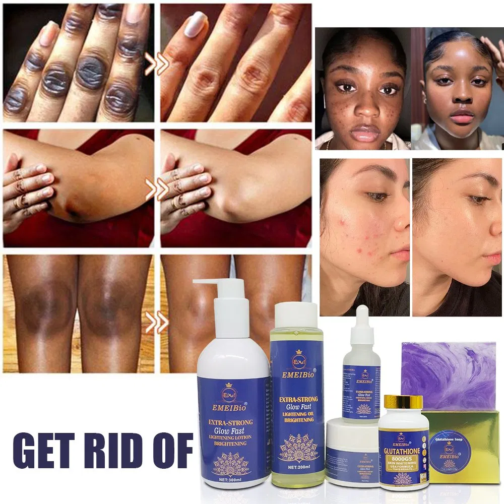 Private Brand Glutathione Antioxidant Repair Skin Cream Set Melanin Removal Whitening Moisture Face Skin Set