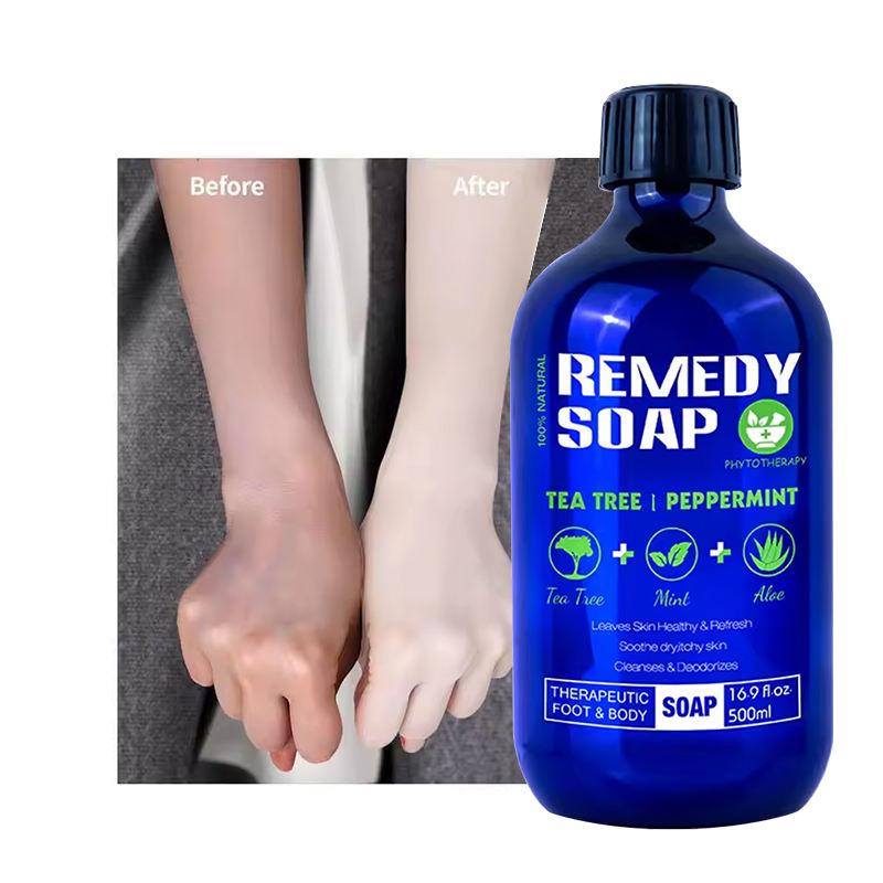 Private Label Natural Organic Body Wash Remedy Soap Rosemary Tea Tree Oil Healing Nourishing Shower Gel for Soothes Liquid Soap