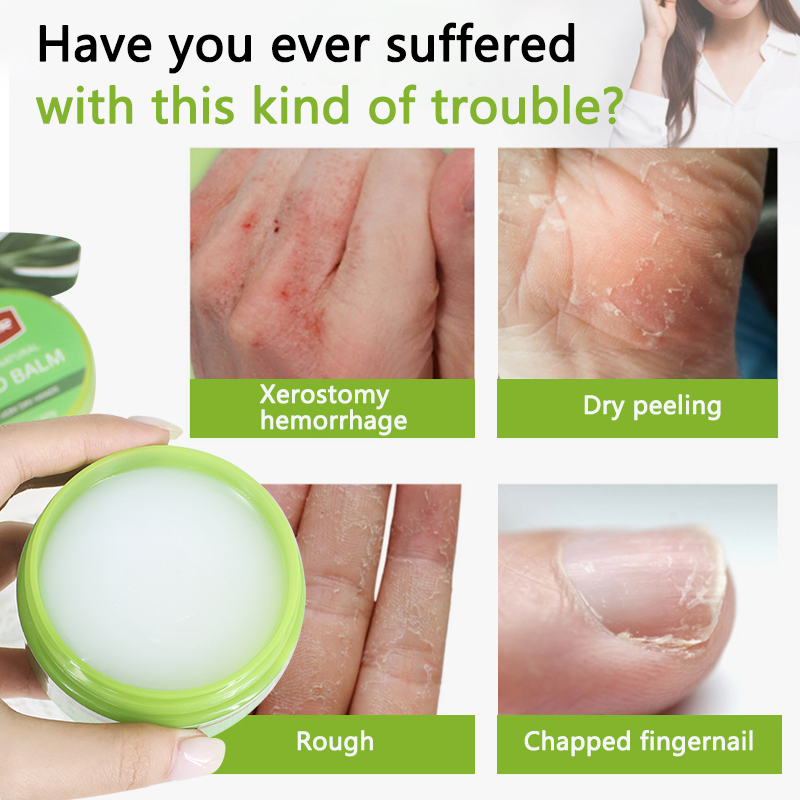 Natural Nourishing Balm for Dry Hand Foot Moisturizing Repairing Highly Effective Moisture Hand Balm Wholesale