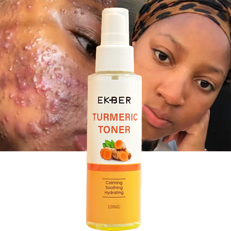 Skin Care Face Mist Spray Facial Vitamin C Skin Turmeric Toner
