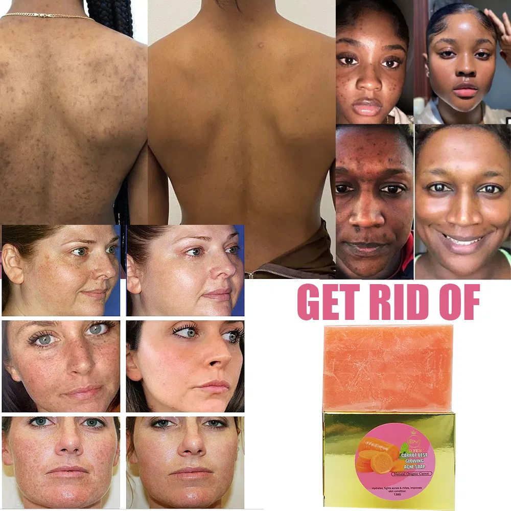 OEM Customized Wholesale Soap Moisturizing Whitening Brightening Suitable All Skin Types Carotene Handmade Soap