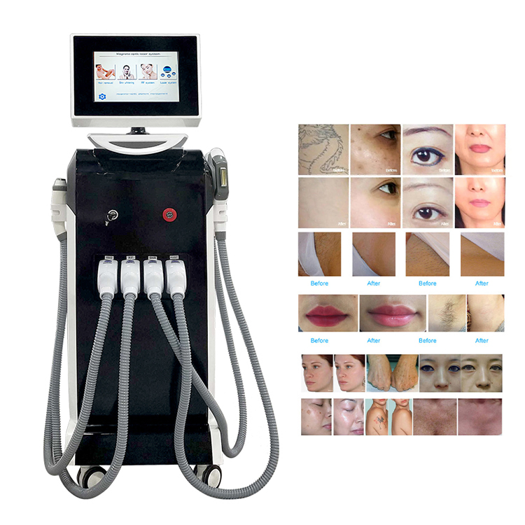 IPL Laser Hair Removal Device Epilation Permanent IPL Technology for Hair Removal Device Skin Care ND YAG Laser Remove Tattoo