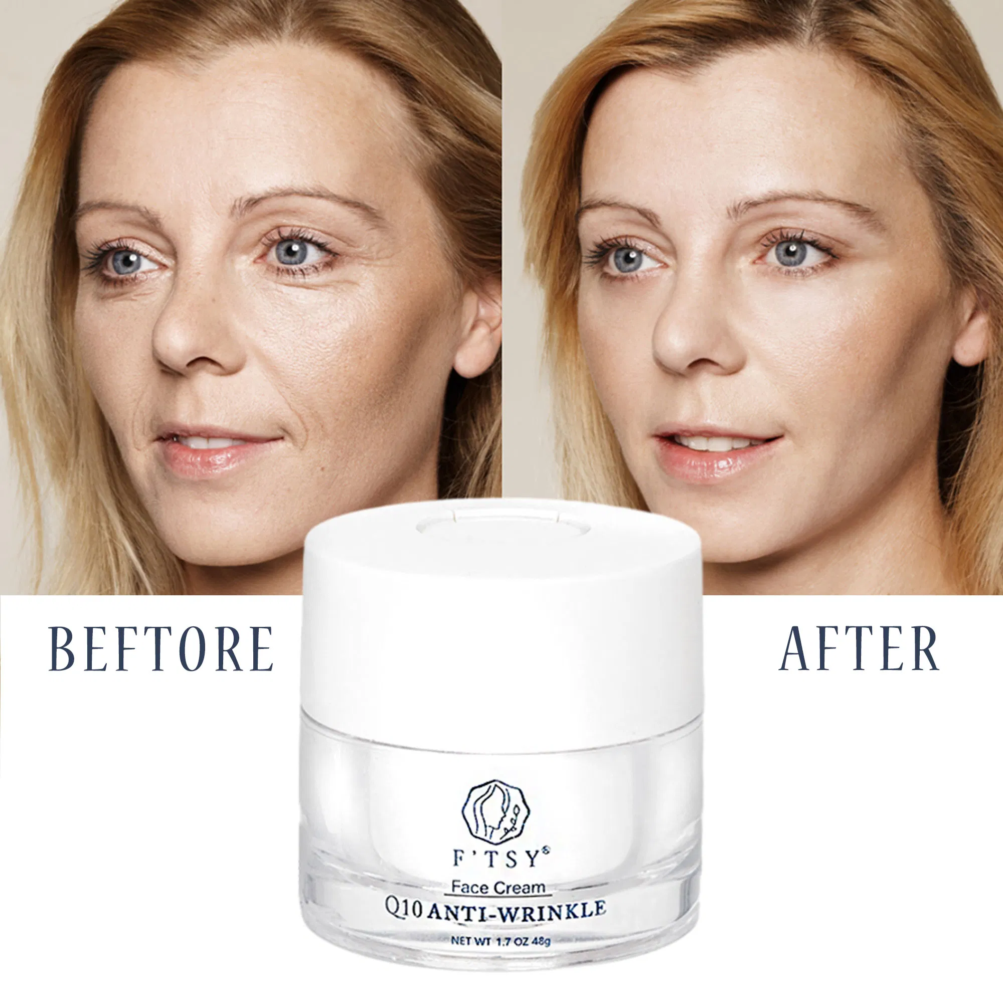 Soothing Q10 Anti Wrinkle Face Cream Moisturizing Antioxidant Facial Cream Private Label