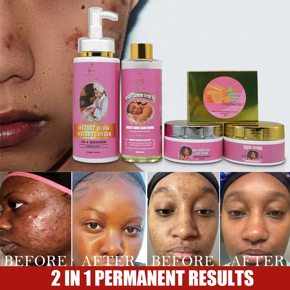 OEM Best-Selling Product Body Face Care Anti-Aging Vitamin C Glutathione Whitening Skincare Set