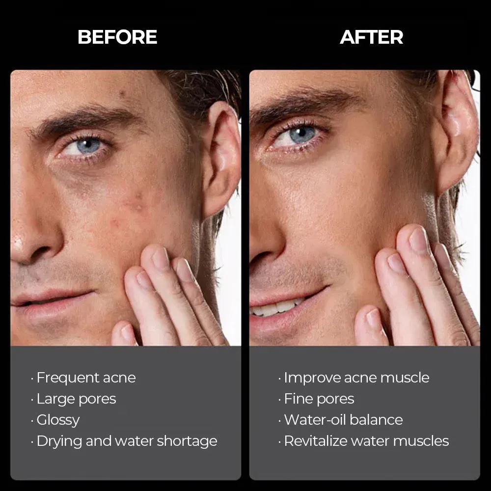 Men's Oil-Control Acne-Fighting Cleanser Blackhead-Cleansing Men's Face Wash