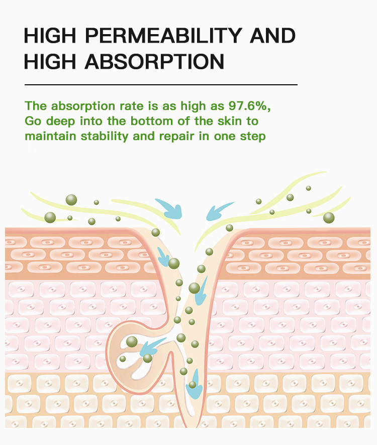 Customize Logo Wholesale Natural Skin Revitalization Moisturizing Smoothing Solution Anti Acne Az Azelaic Acid Face Serum