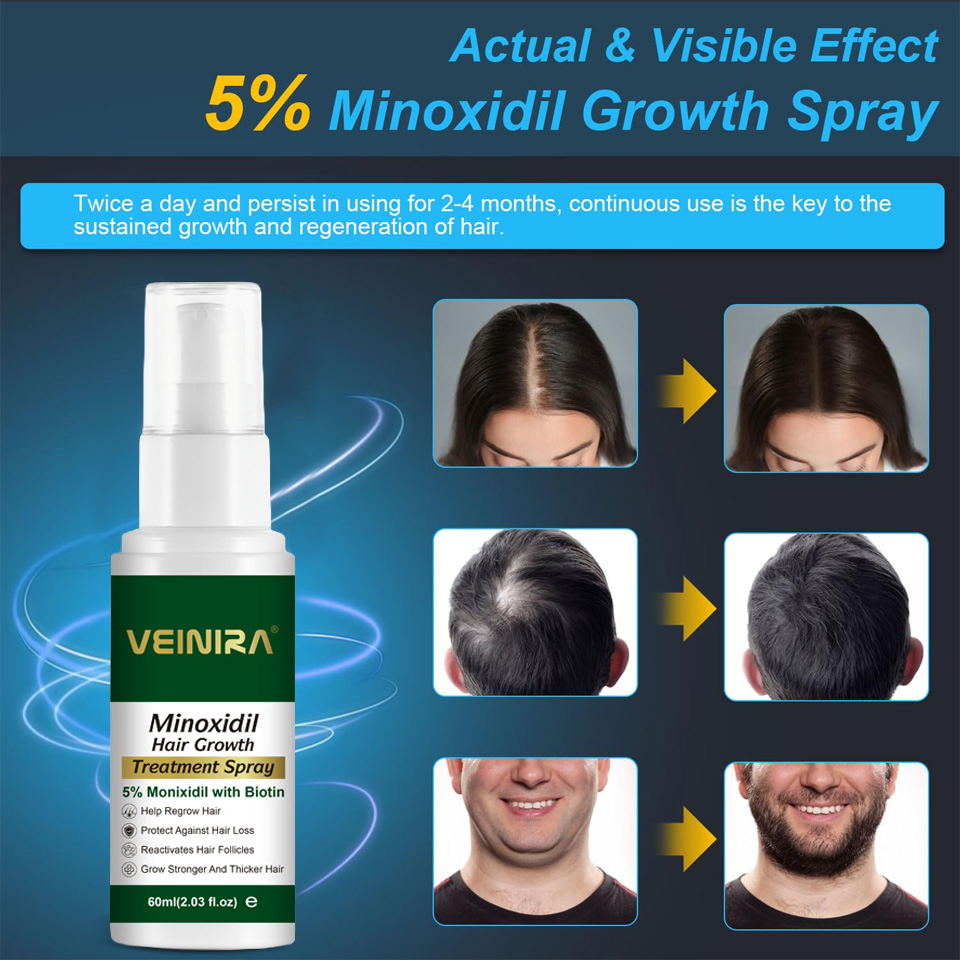 Factory OEM Private Label Hair Growth Serum with Biotin Minoxidil Rosemary Oil Anti Hair Lose