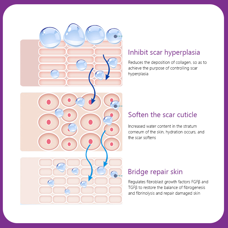 Ekber Skincare Scars Spot Removing Repair Skin Whitening Anti Freckle Cream