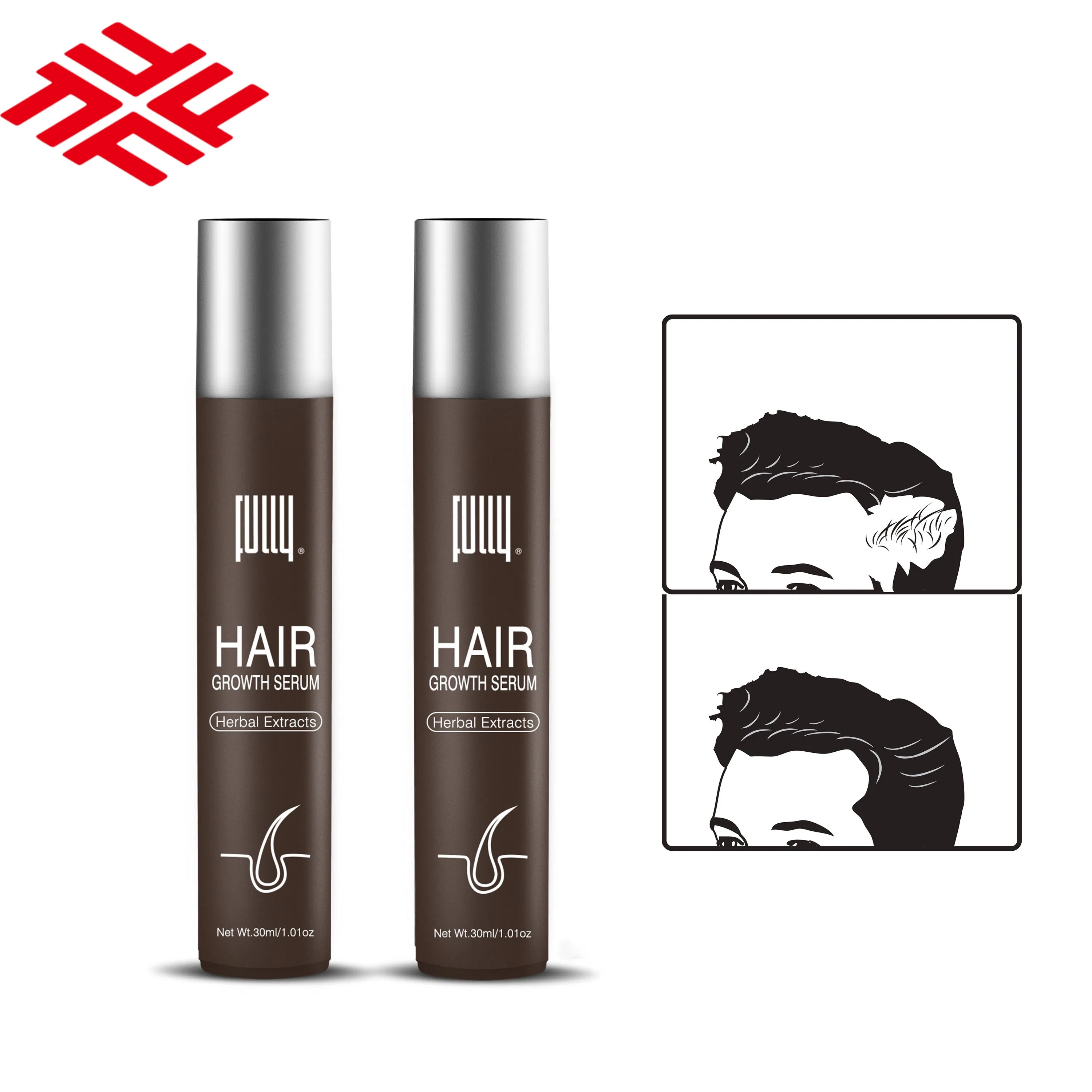 Professional GMPC Factory Supplier Promote Hair Thickening Anti Loss Fully Hair Growth Serum for Hair Loss Solution