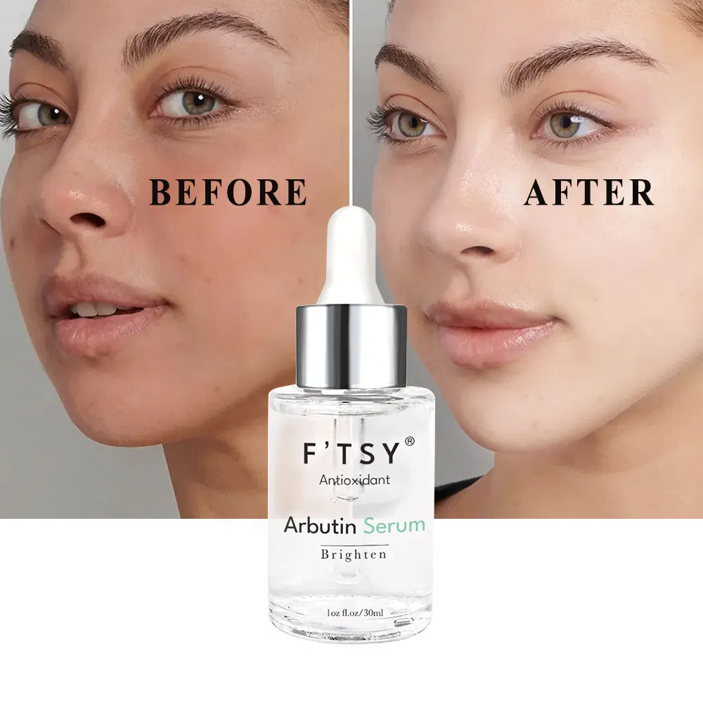 OEM Vegan Natural Whitening Arbutin Serum Reduce Dark Spot Brightening Face Care Serum