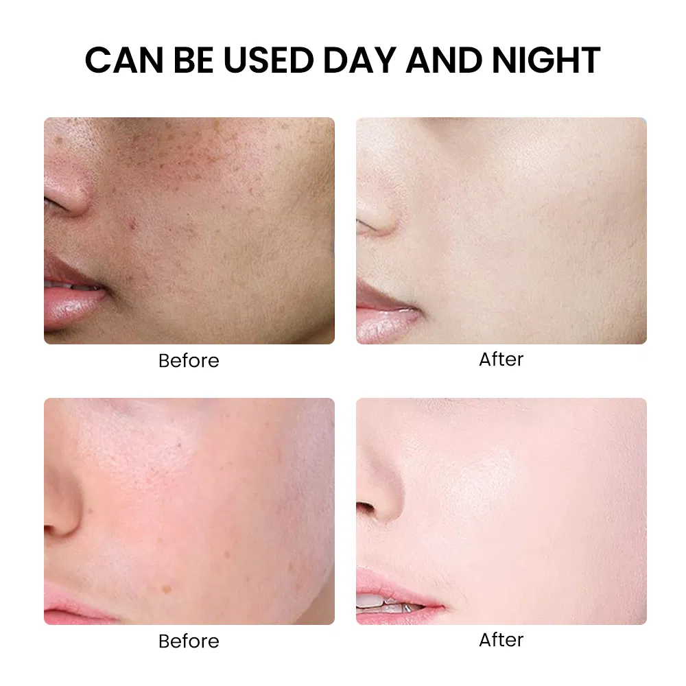 Korean Skin Care Set Rosewater Green Tea Vitamin E Ceramide Niacinamide & Moisturizing Whitening Anti-Aging Firming OEM/ODM