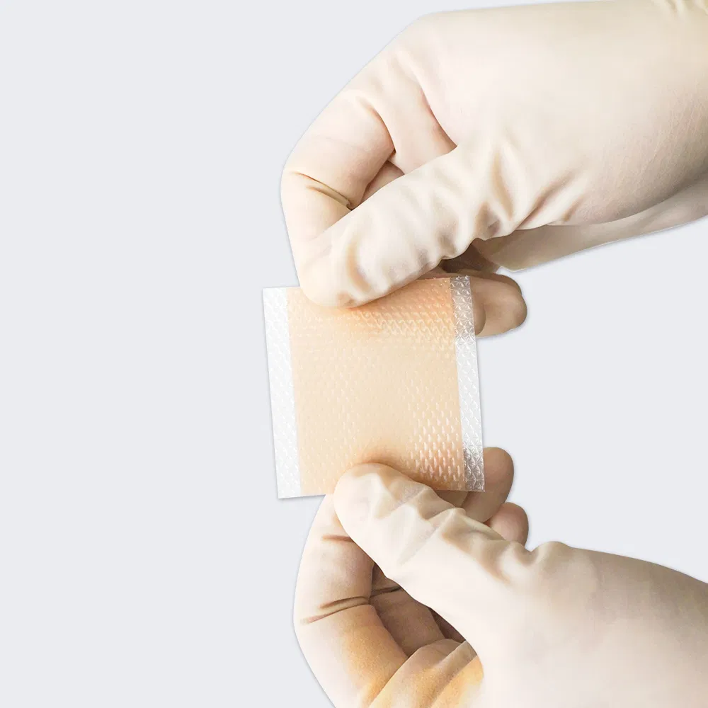 FDA Approved Wholesale Premium Silicone Scar Jumbo Roll Patch Private Label Skin Care Silicone Scar Sheet Gel Large Roll