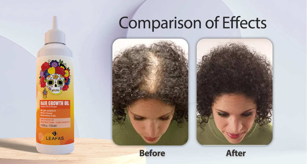 Factory Price Wholesale OEM/ODM 4oz Light Weighted Non-Greasy Revitalize Scalp Hair Growth Oil