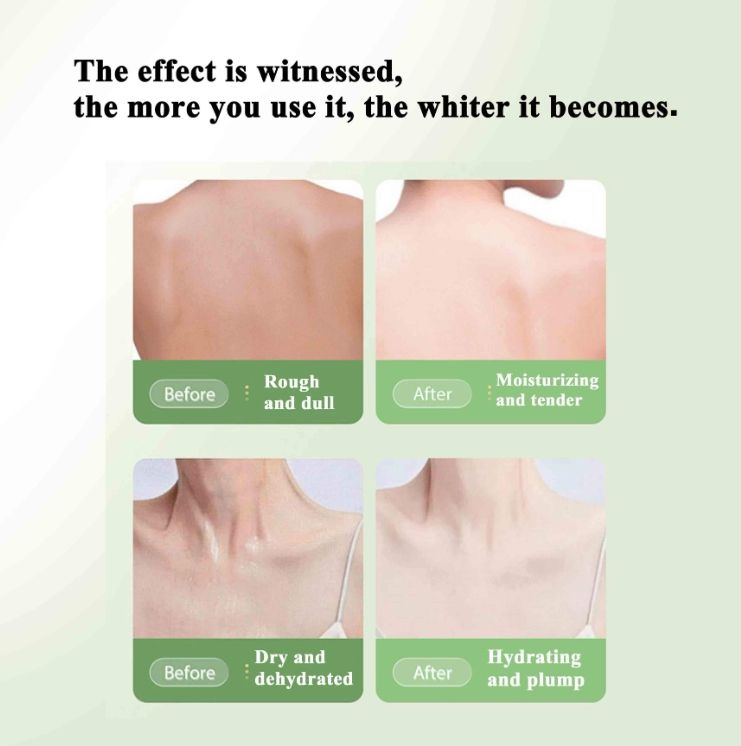 Active Super 7 Days Whitening Body Lotion - Improve Skin Tone & Nourish Skin Care