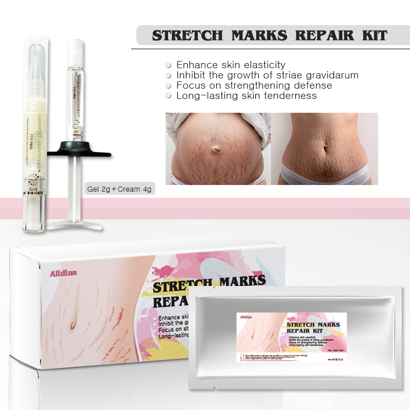 OEM Body Face Oil Natural Organic Scars Stretchmarks Skincare Hydrates Skin Anti Stretch Marks Scar Stretch Marks Repair Kit