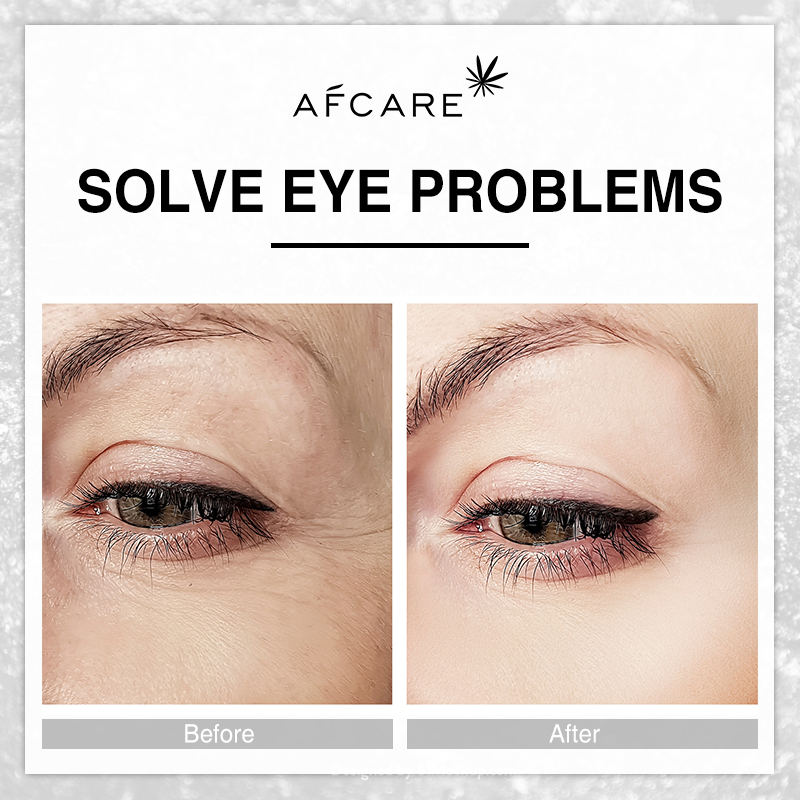 Best Instantly 1minute Reduce Eye Bags Wrinkles Eye Cream Private Label