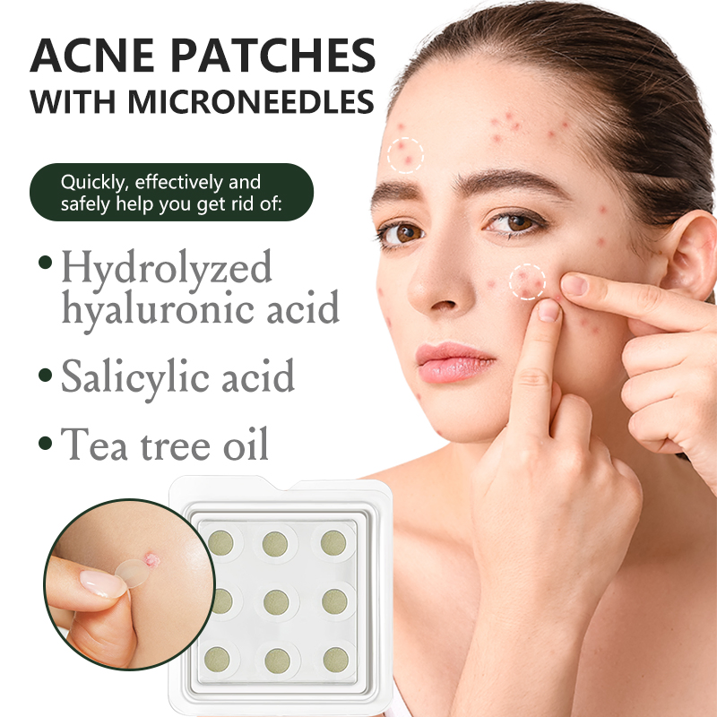 Пластыри от прыщей с микроиглами, медицинский класс