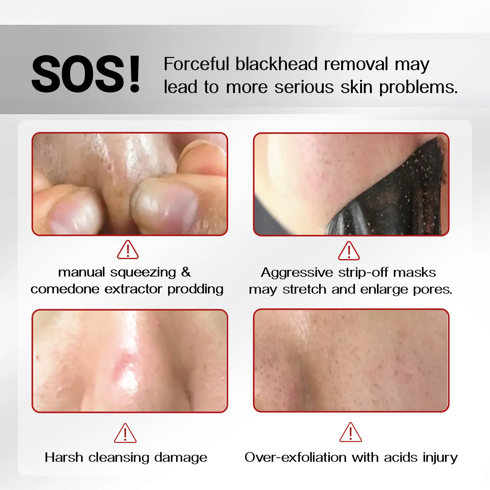 Beauty Cosmetics Skin Care Balances Oil Minimizes Pores Blackhead Remover Three-Piece Set