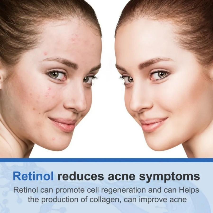 Wholesale Firming High Quality Retinol Restorative Face Cream