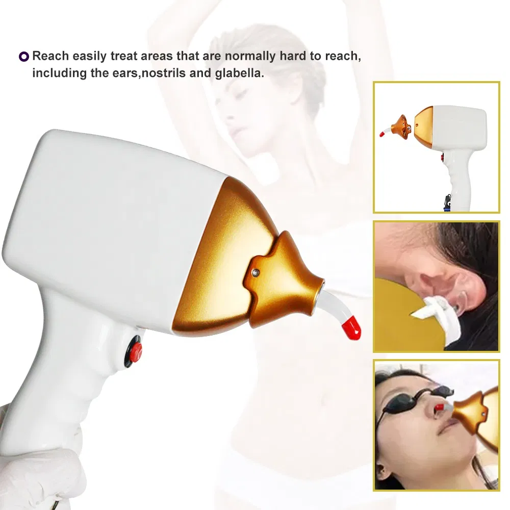 High Quality Diode Laser 755nm 808nm 1064nm Titanium Platinum Triple Wavelength Hair Removal Therapy Skin Rejuvenation Machine