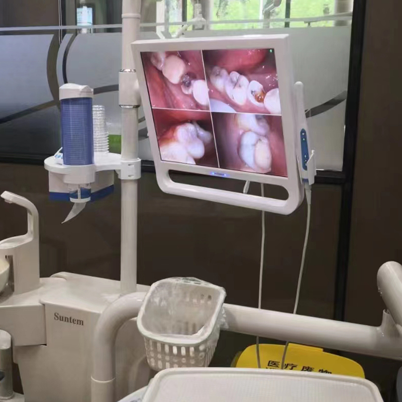 Best VGA Dental Intraoral Camera with 17 Inch Screen System Connect for Dental Unit
