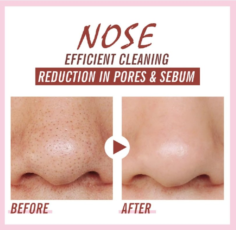 Quickly Removing Blackheads Shrink Pores White Nose Patch Mask