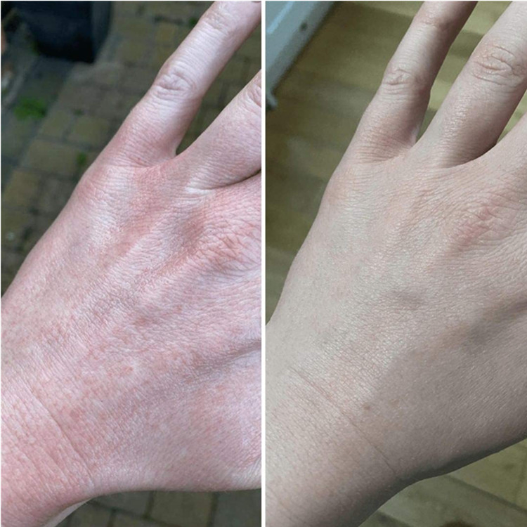 Moisturising Natural Caring Hand Cream for Sensitive and Dry Skin