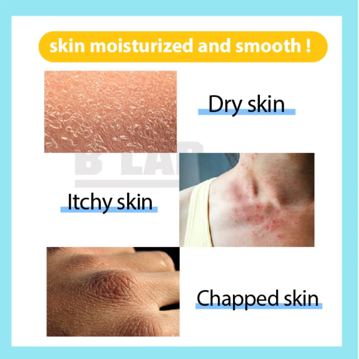 OEM/ODM Moisturizer Body Cream Body Lotion for Dry Skin & Itchy Skin
