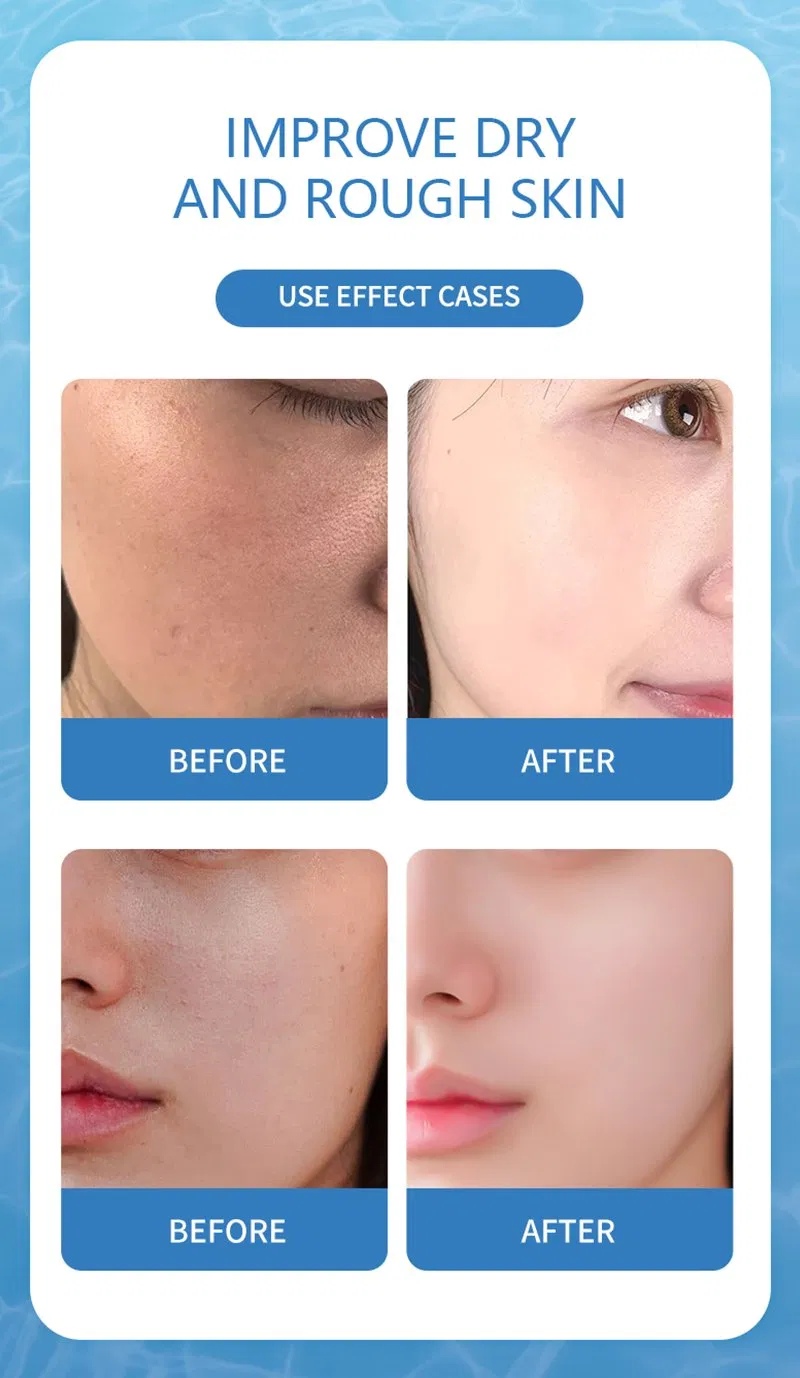 Private Label Organic Instant Fast Anti Aging Anti Wrinkle Remover Eye Bag Eye Cream