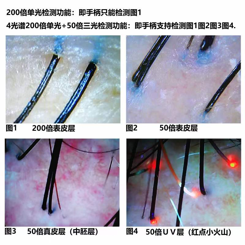 Portable Desktop 5 in 1 Hair Scalp Analyzer Hair Growth Machine Hair Care Treatment Regrowth Machine