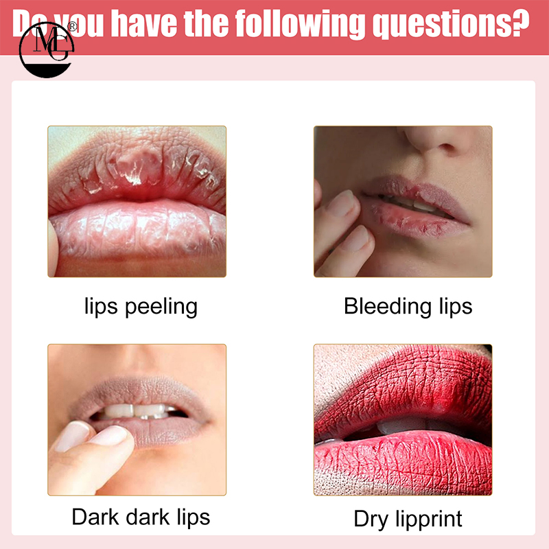Sun Protection for Active Lifestyles Female Waterproof Lip Balm