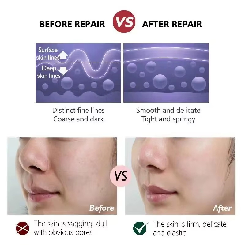 OEM Custom Logo EGF Oligopeptide Serum Lyophilized Powder Set for Acne Removing Face Repairing Epidermal Growth Factor Solution