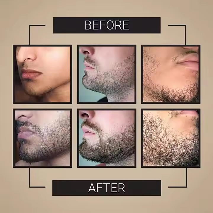 Natural Regrowth Beard Serum Thickening Nourishing Strengthening Beard Anti-Loss