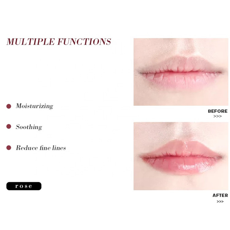 Beauty Nourishing Deep Moisturizing Rose Red Hydrogel Lip Sleeping Mask Patch Manufacturer
