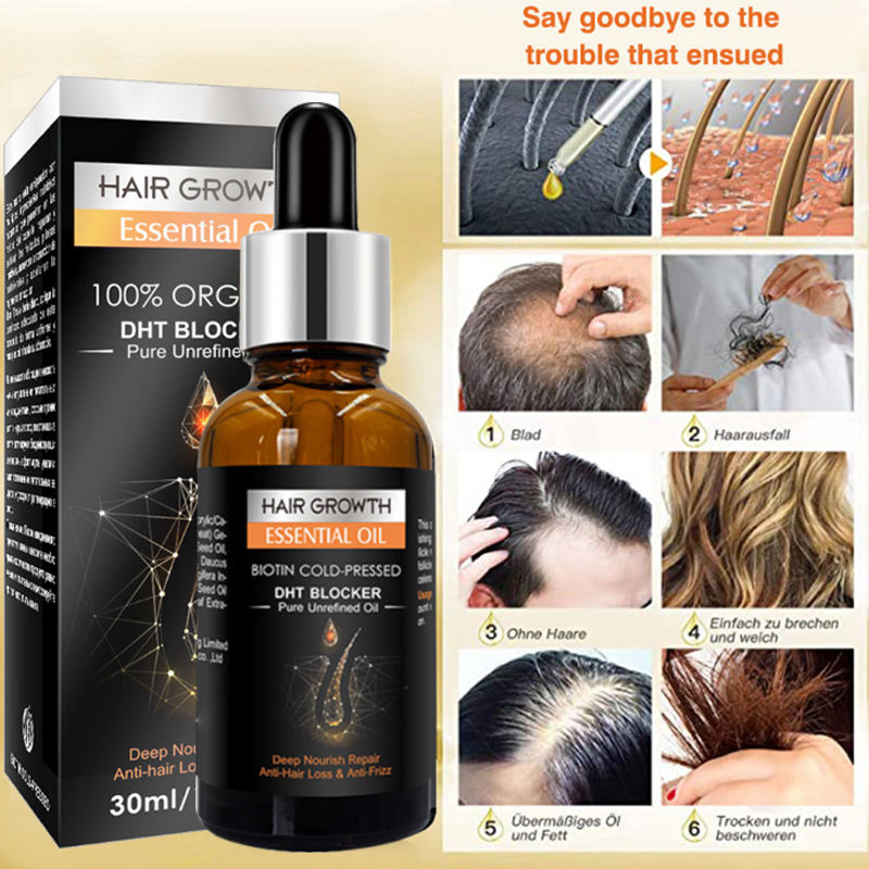 Private Label Hair Care Growth Oil Biotin Regrowth Treatment for Scalp Hair Loss Thinning Hair Growth Essential Oil