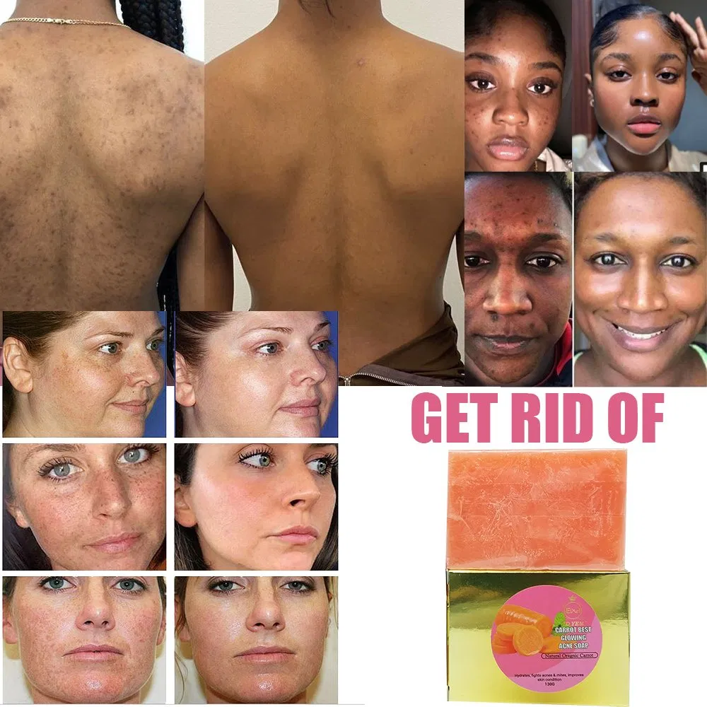 Wholesale Whitening Anti Acne Cleansing Refresh Skin Natural Ingredient Carotene Soap