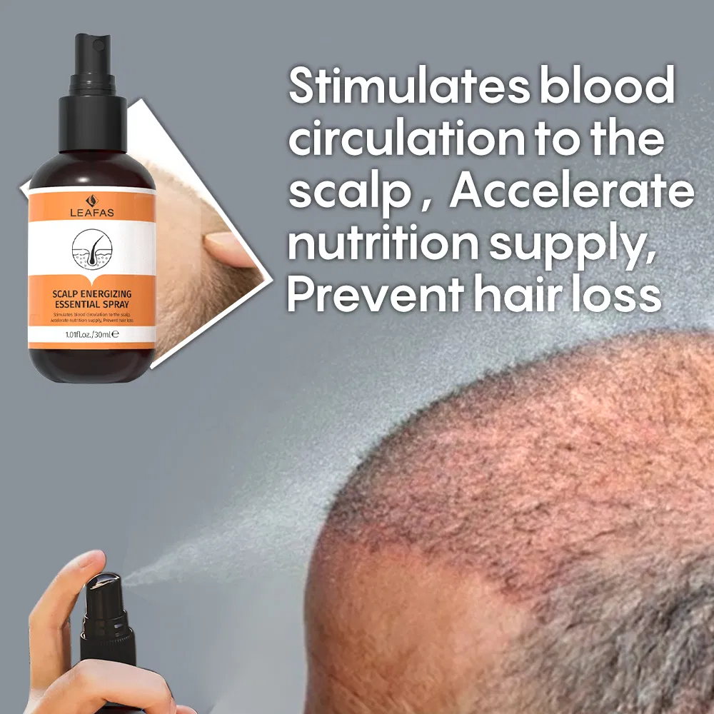 Private Label 100ml Prevent Hair Oil Hair Growth Oil