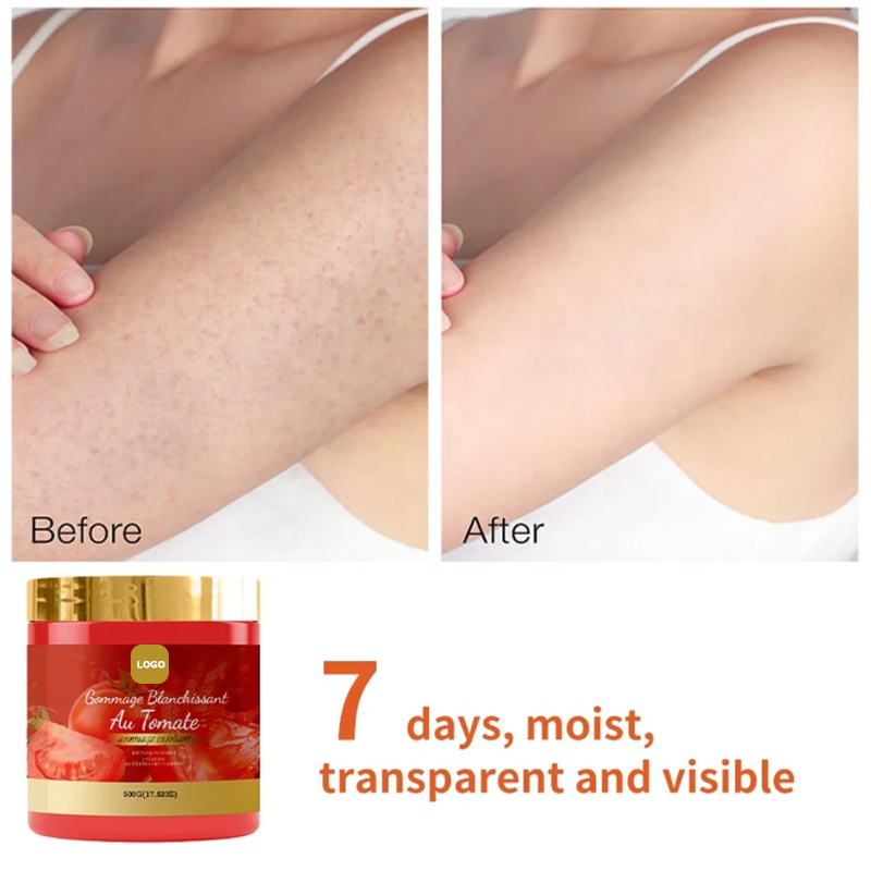 Ditong Oemodm Tomato Scrub Organic Bath Salt Improve Chicken Skin Exfoliant Whitening Body Scrub