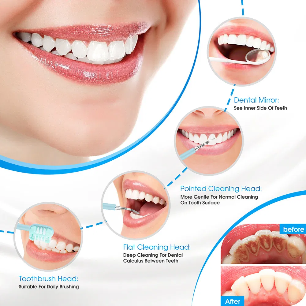 Multi-Function Smart Sonic Electric Toothbrush Dental Cleaner, Calculus Remover 5-Mode Wireless Charging