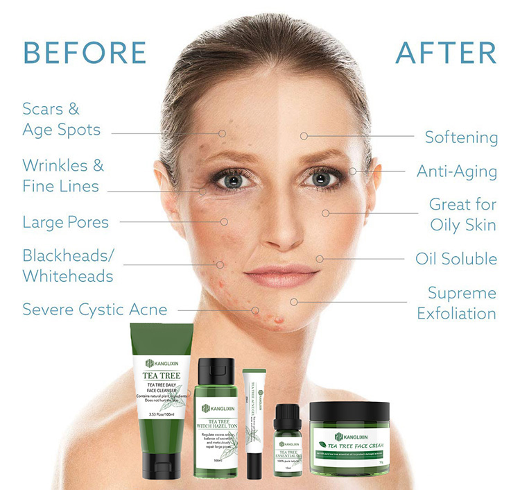Organic Tea Tree Anti Acne Skin Care Set Private Label Acne Treatment Skin Care Set