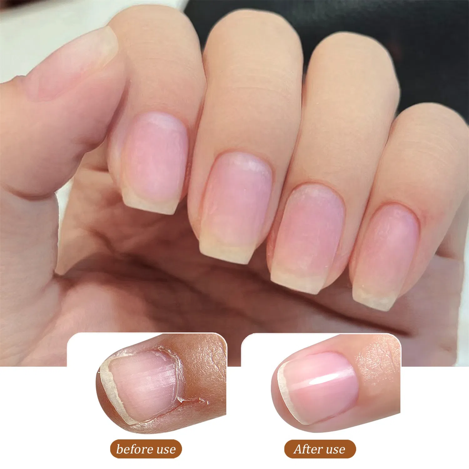 Russian Nail Aid Nourishes Nails Quickly Softens and Removes Dead Skin Without Hurting Hands Prpcessed Liquid