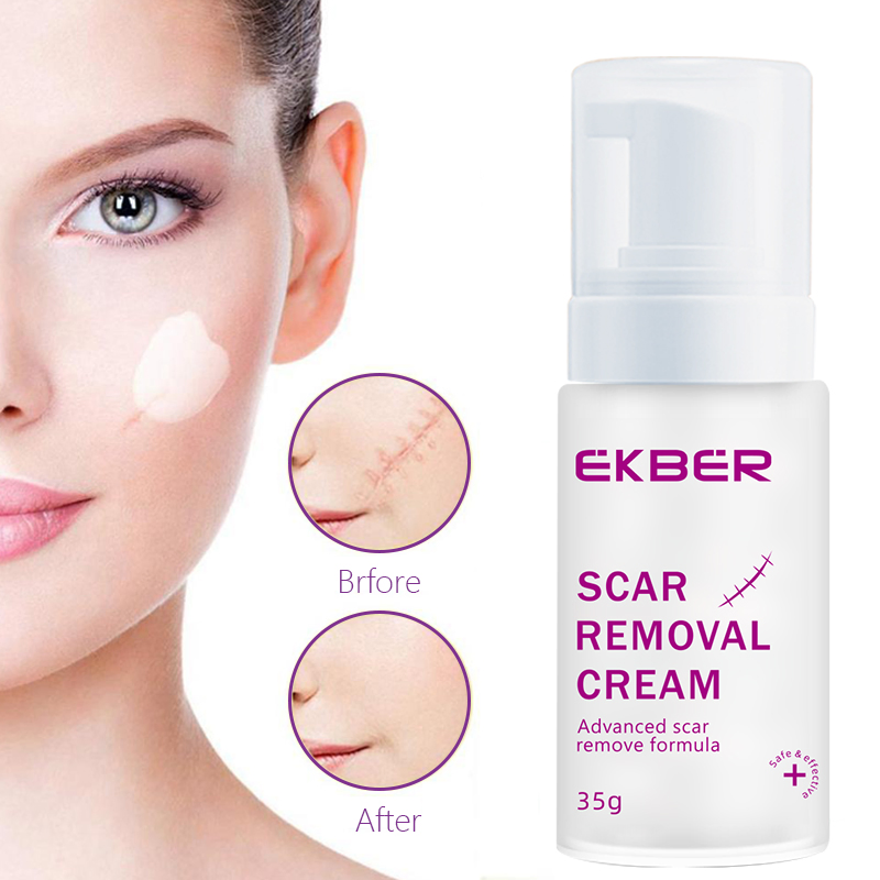 Ekber Skincare Scars Spot Removing Repair Skin Whitening Anti Freckle Cream