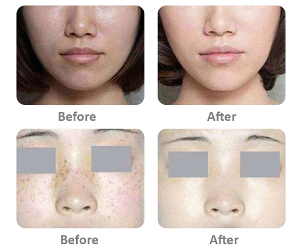 2022CE ISO FDA Wholesale Glutathione Injection Power Luthione Cindella Glutathione Skin Anti-Oxidation Vitamin C Glutax Whitening Injection Serum for Face White