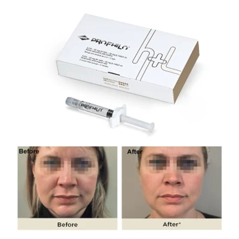 Profhilo H+L Winkle Removal Face Lifting Filler Profhilo